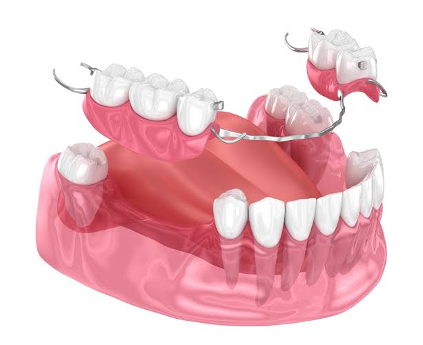 Dental model, illustrative dental-care visual
